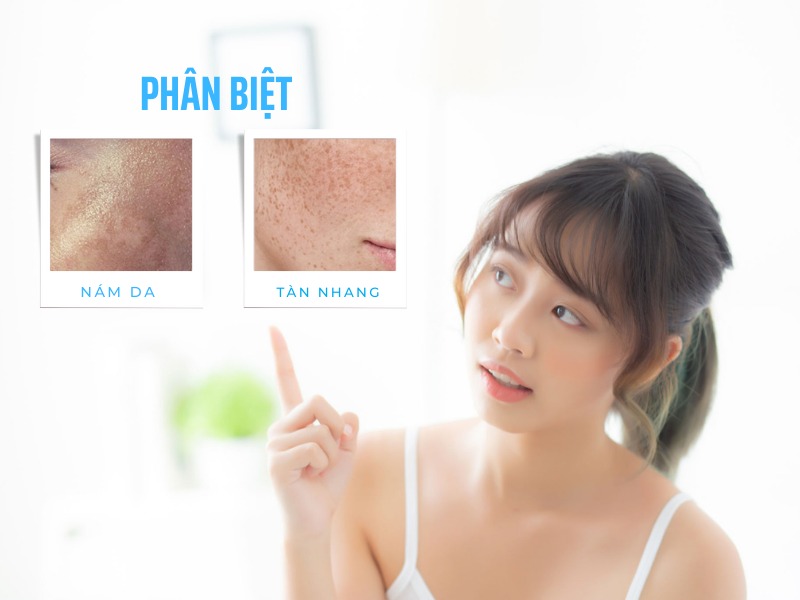 Sự khác biệt giữa nám và tàn nhang