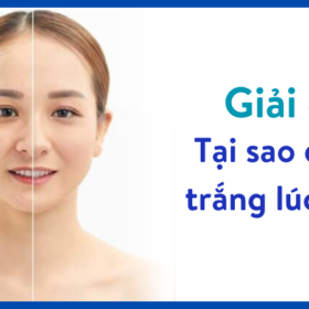 Tại sao da lúc trắng lúc đen