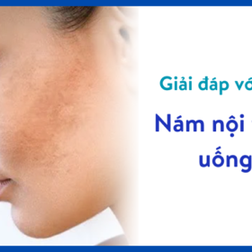 nám nội tiết uống gì