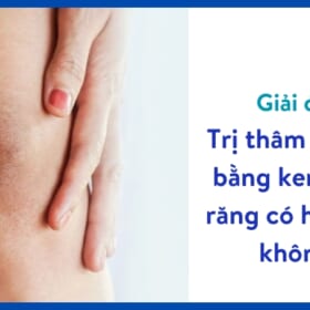 trị thâm đầu gối bằng kem đánh răng